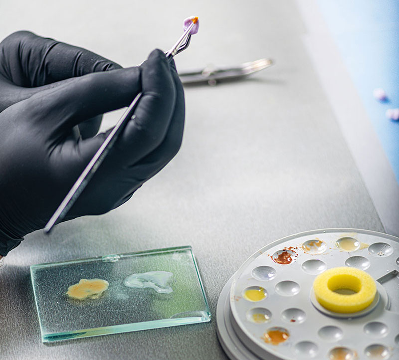 Ιωάννης Τζόβολος - Οδοντοτεχνικό εργαστήριο Jovolos Dental Lab